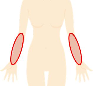 ミュゼプラチナム　両ヒジ下